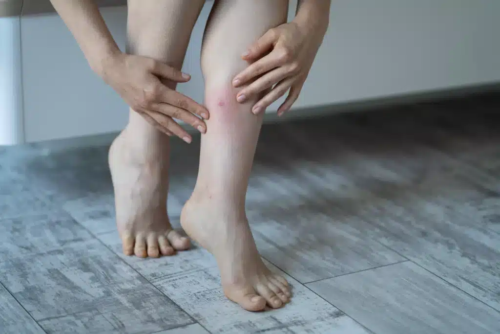 puces de parquet